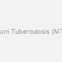 Human Mycobacterium Tuberculosis (MT) IgG Rapid Test Kit